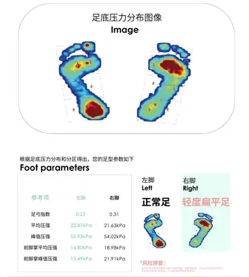 Features of Static Plantar Pressure Analysis System GaitnovateⅠ