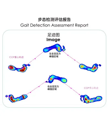 Dynamic Plantar Pressure Analysis System-GaitnovateⅡ