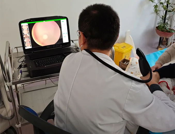 Quality Control Process of Ultra-Wide Angle Fundus Camera