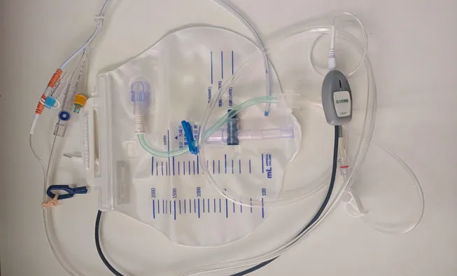 Sighture Temperature and Pressure Monitoring Urinary Catheterr: Clinical Procedure Guide