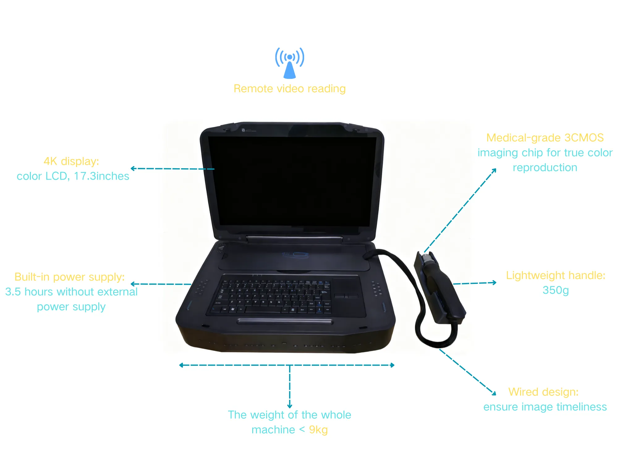 Features of Portable Ultra-wide-angle Fundus Camera-PUWF