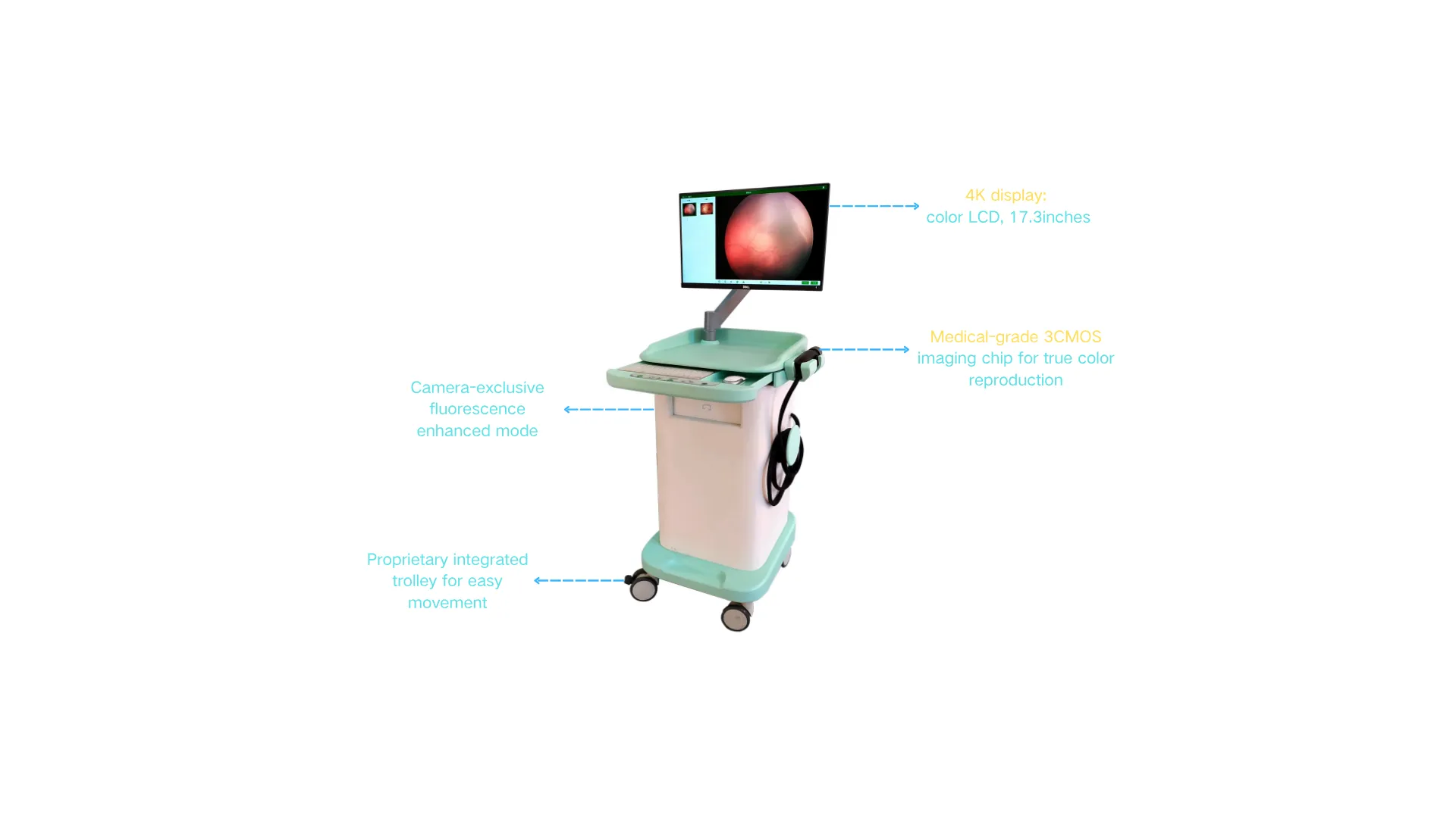 Features of Table-mounted Ultra-wide-angle Fundus Camera-TUWF