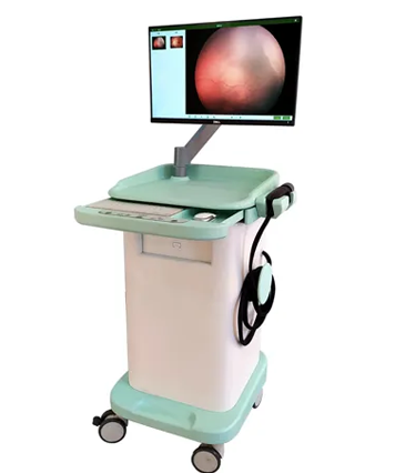 ultra wide angle fundus camera