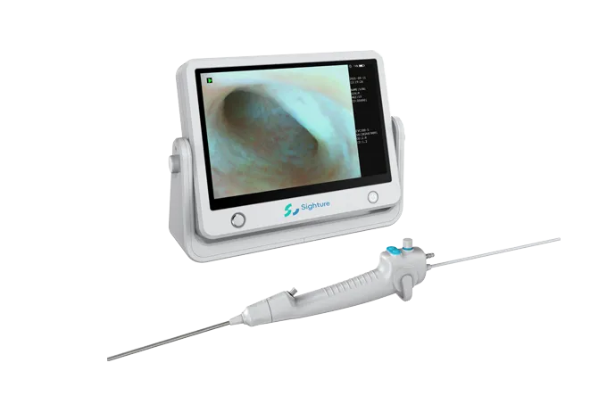 Hysteroscope